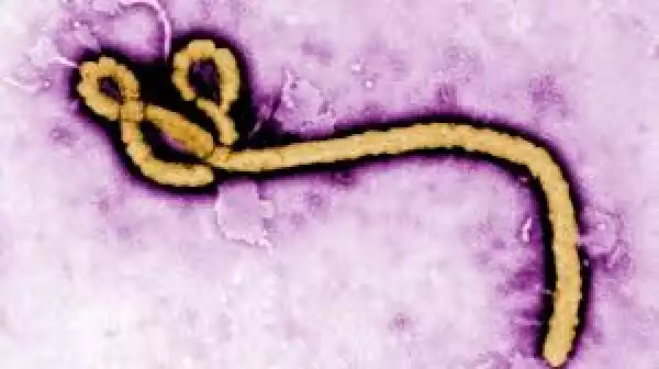 Ebola vaccine trials set to begin in September